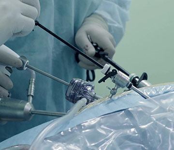 Laparoscopy Melomed