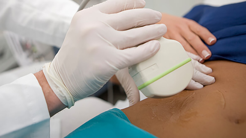 Endoscopic Procedures